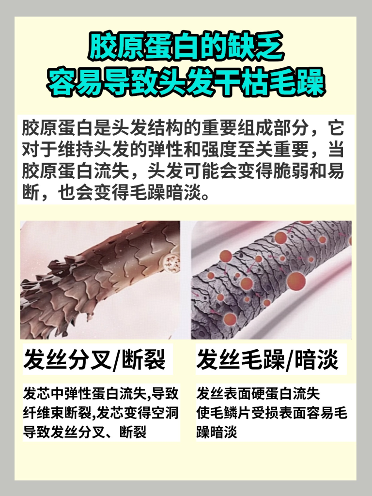 今日科普：头发干枯易掉？关键要补胶原？